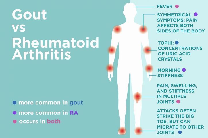 Gout And Vitamin D