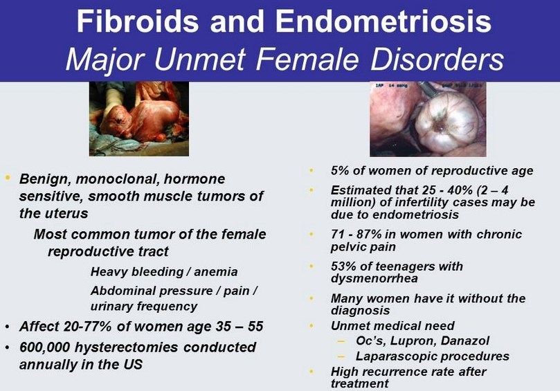 Dysmenorrhea - Wikipedia