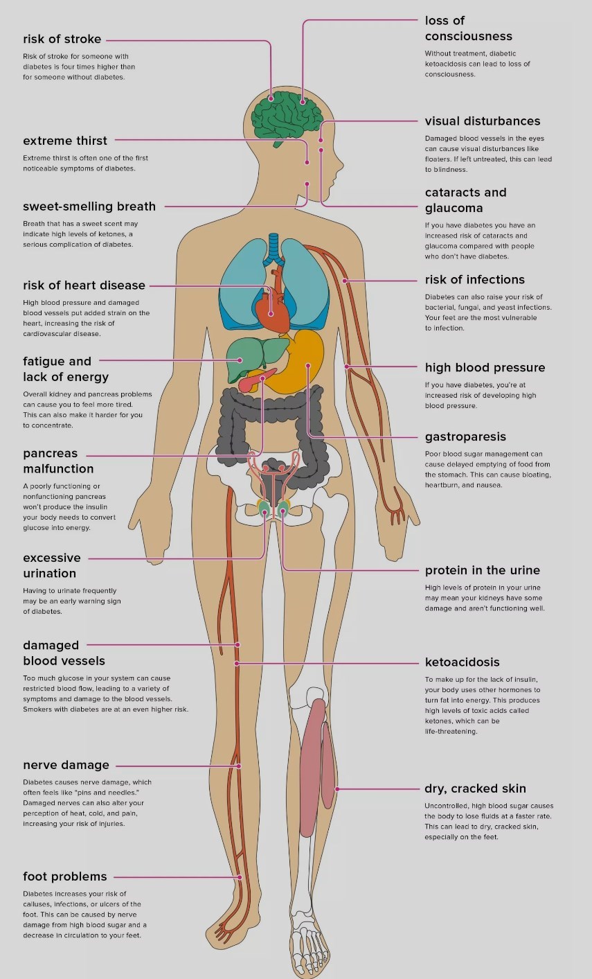 Overview Diabetes And Vitamin D