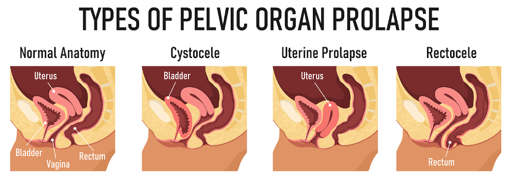 13+ Back Pain Organ Chart